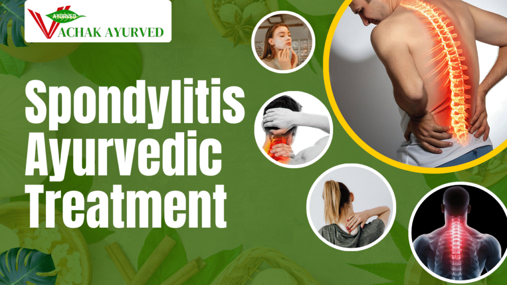 Spondylitis Ayurvedic Treatment